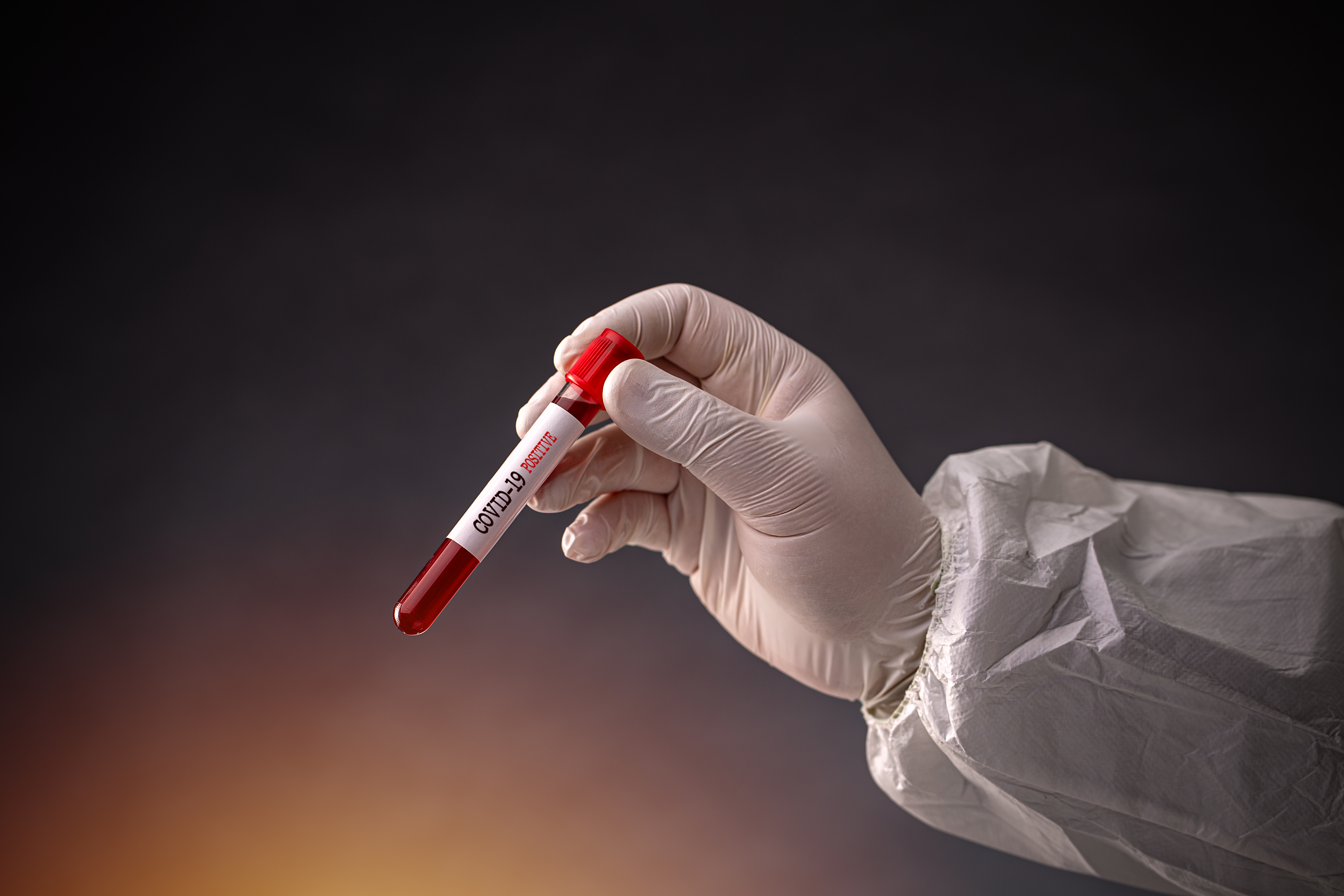 Nagy bejelentést tett a WHO: hivatalosan is véget ért a Covid-vészhelyzet