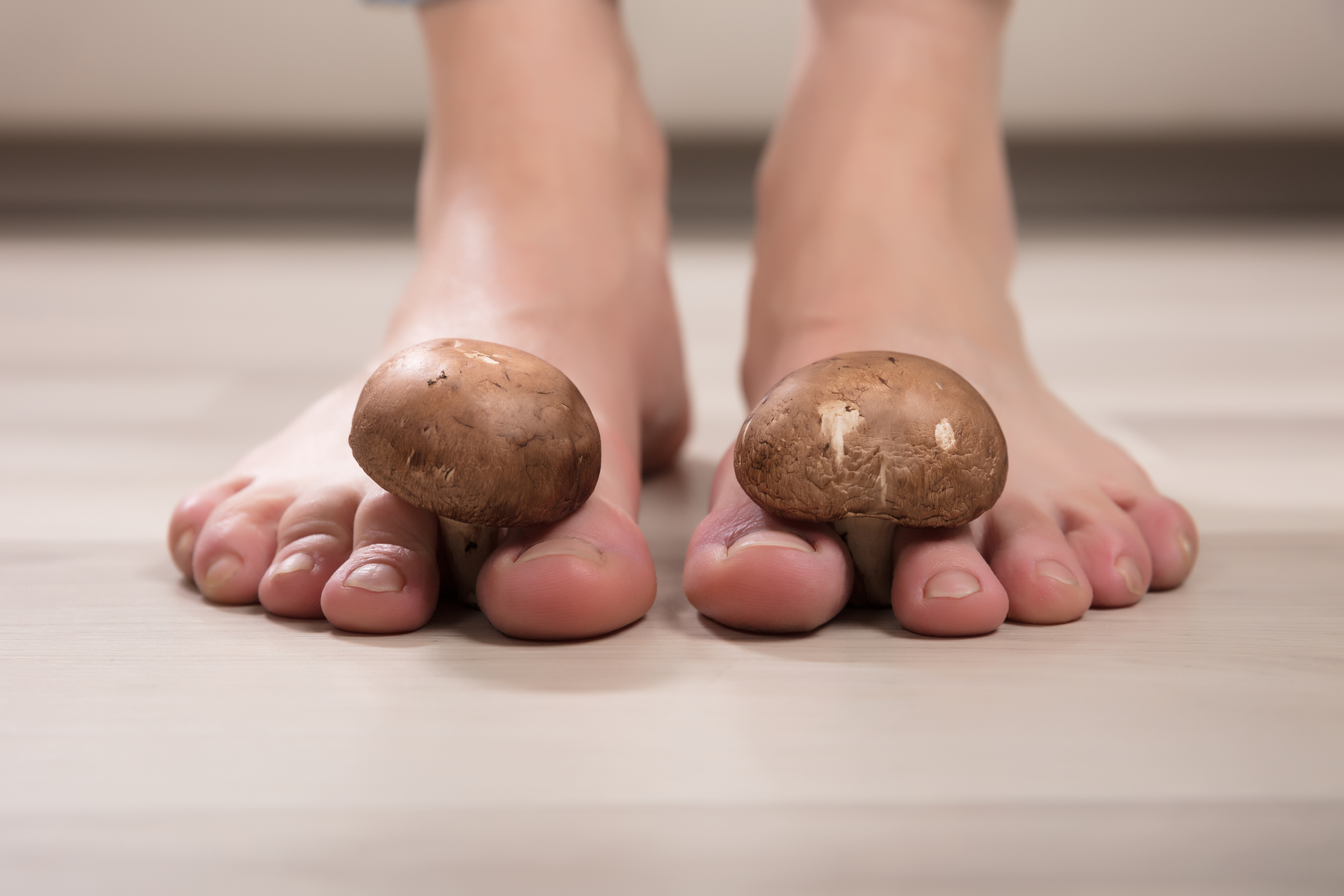 mit tegyünk, ha körömgomba fut hands gombás köröm közelében