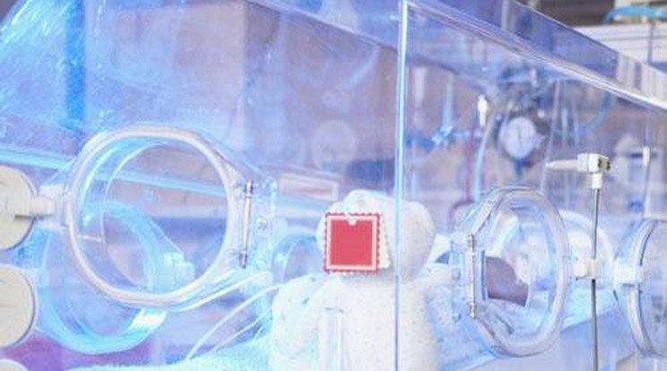 Fertőzés a szegedi gyermekklinikán - meghalt egy csecsemő!