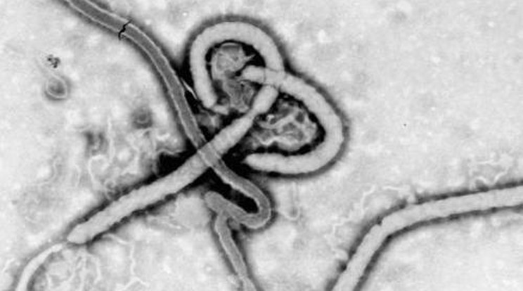 Egy román férfit is Ebola-fertőzés gyanújával kezelnek 