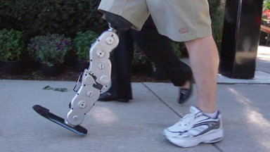 Pierwsza bioniczna proteza nogi