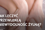 Jak leczyć przewlekłą niewydolność żylną?