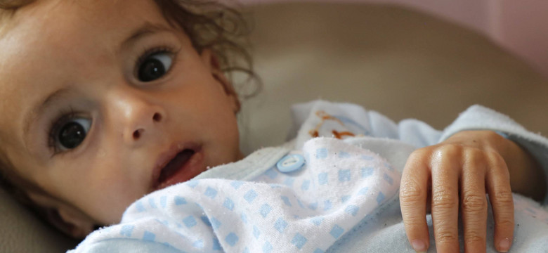 Jemen głoduje. Co nas to powinno obchodzić?