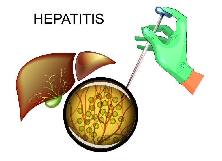 hepatitis_c_0