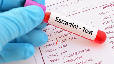 Estradiol - normy dla kobiet
