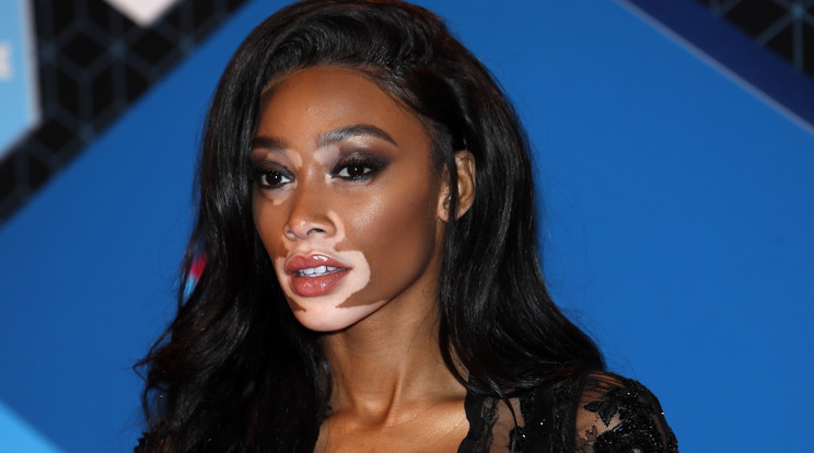 Winnie Harlow szexi fotót osztott meg magáról / Fotó: AFP