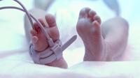 Lekarze złamali dziecku nogę podczas porodu