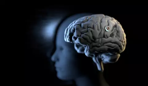 Pierwszy pacjent z Neuralink steruje komputerem myślami i... gra w Cywilizację