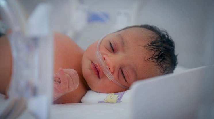 Jemenben már születéstől kezdve nem az élet, hanem a túlélés a cél / Fotó: Unicef