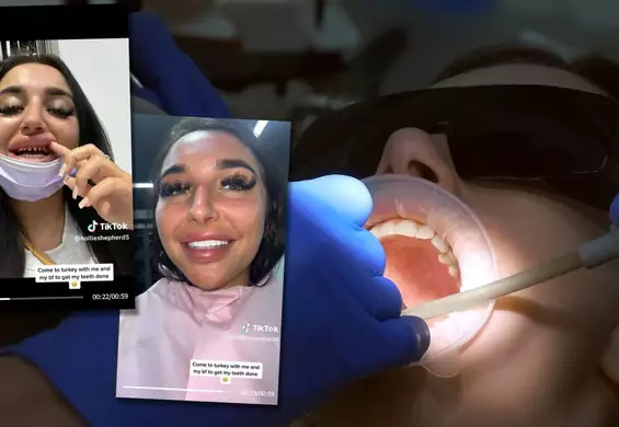 Tiktokerka pokazała, jak piłują zęby w Turcji. Wideo podbija sieć