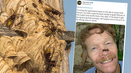 Jak boli użądlenie szerszenia? Jason Schmidt dał się kąsać najgorszym owadom na świecie