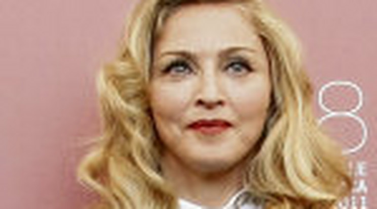 Felismerhetetlenné alakíttatta arcát Madonna!
