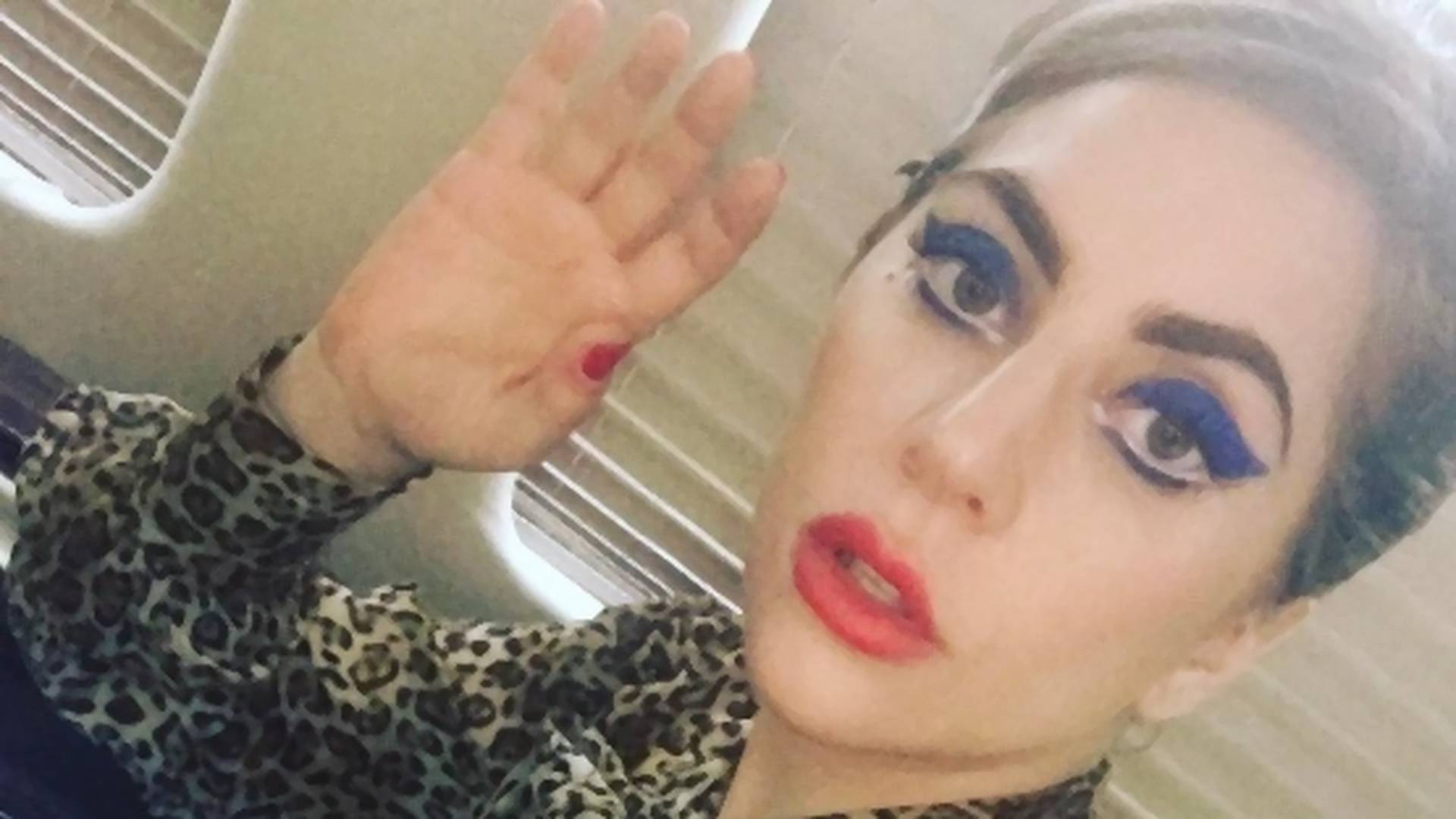 Lejdi Gaga o povredi koja joj je ugrozila karijeru