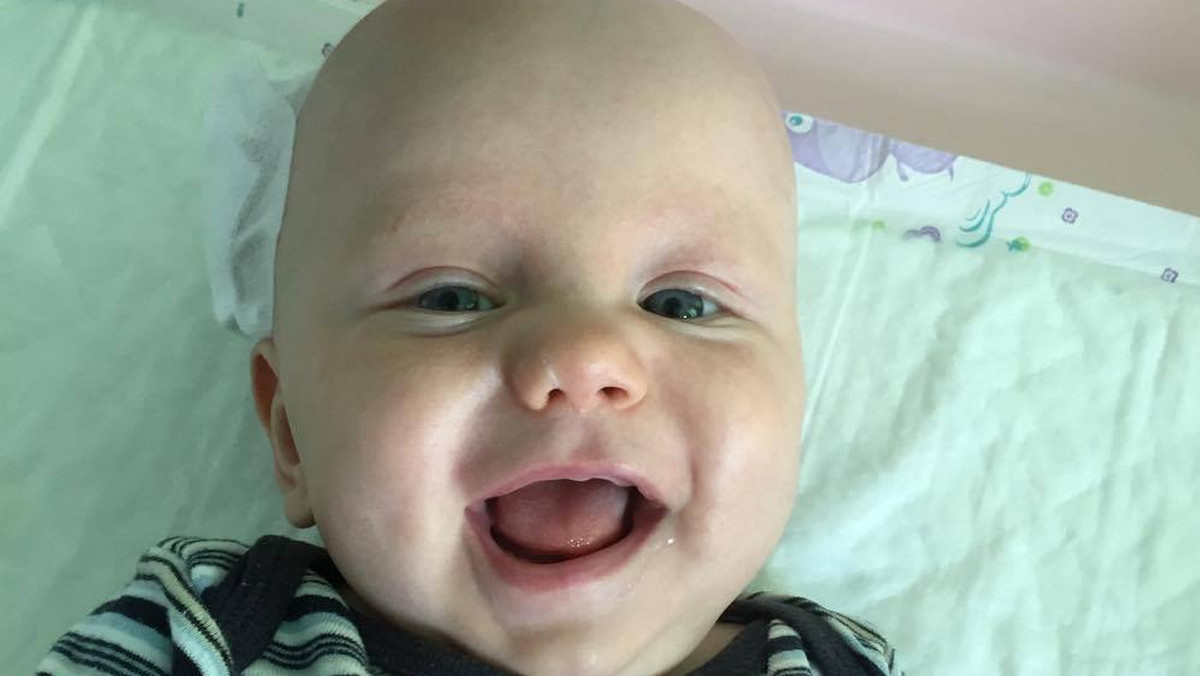 Rodzice Tymka z Białej na Opolszczyźnie mają niewiele czasu, by zebrać potrzebne środki na operację synka. Chłopiec urodził się w ósmym miesiącu, gdy na badaniach wykryto u niego guza mózgu.