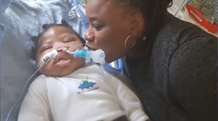 Nagynénje puszilgatja az agykárosult kisbabát / Fotó: YouTube