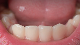 Powiedz aaaaa..., czyli jak stan zębów wpływa na twoje zdrowie?