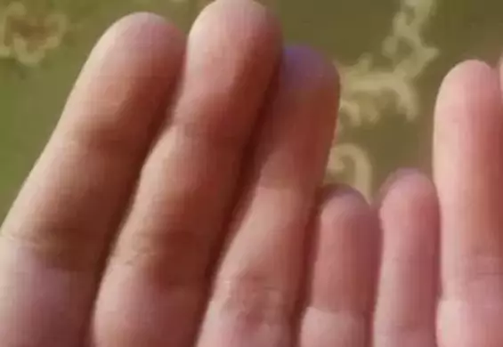 Co jest nie tak z palcami tego mężczyzny? To naprawdę dziwne
