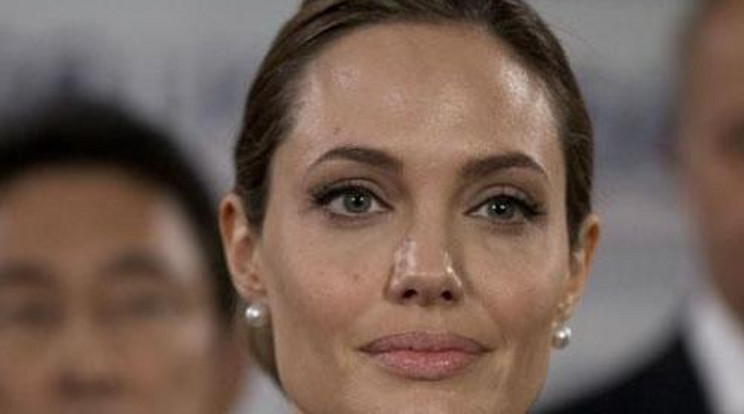 Megszólalt Angelina Jolie orvosa