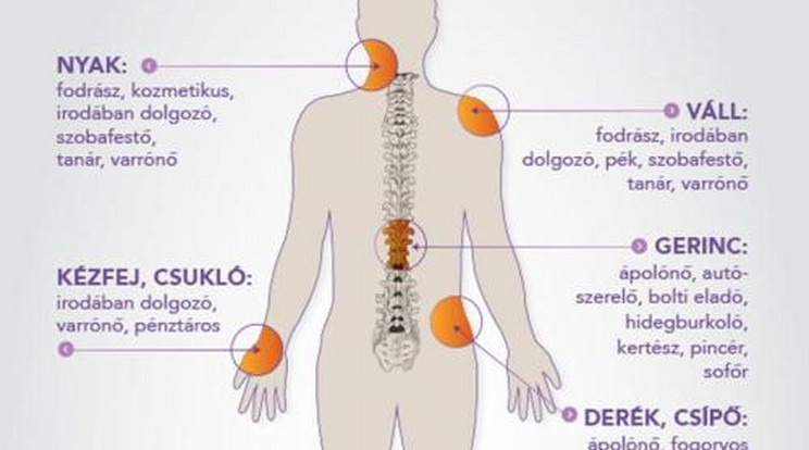 Ha megmondod hol fáj, megmondom mi a foglalkozásod