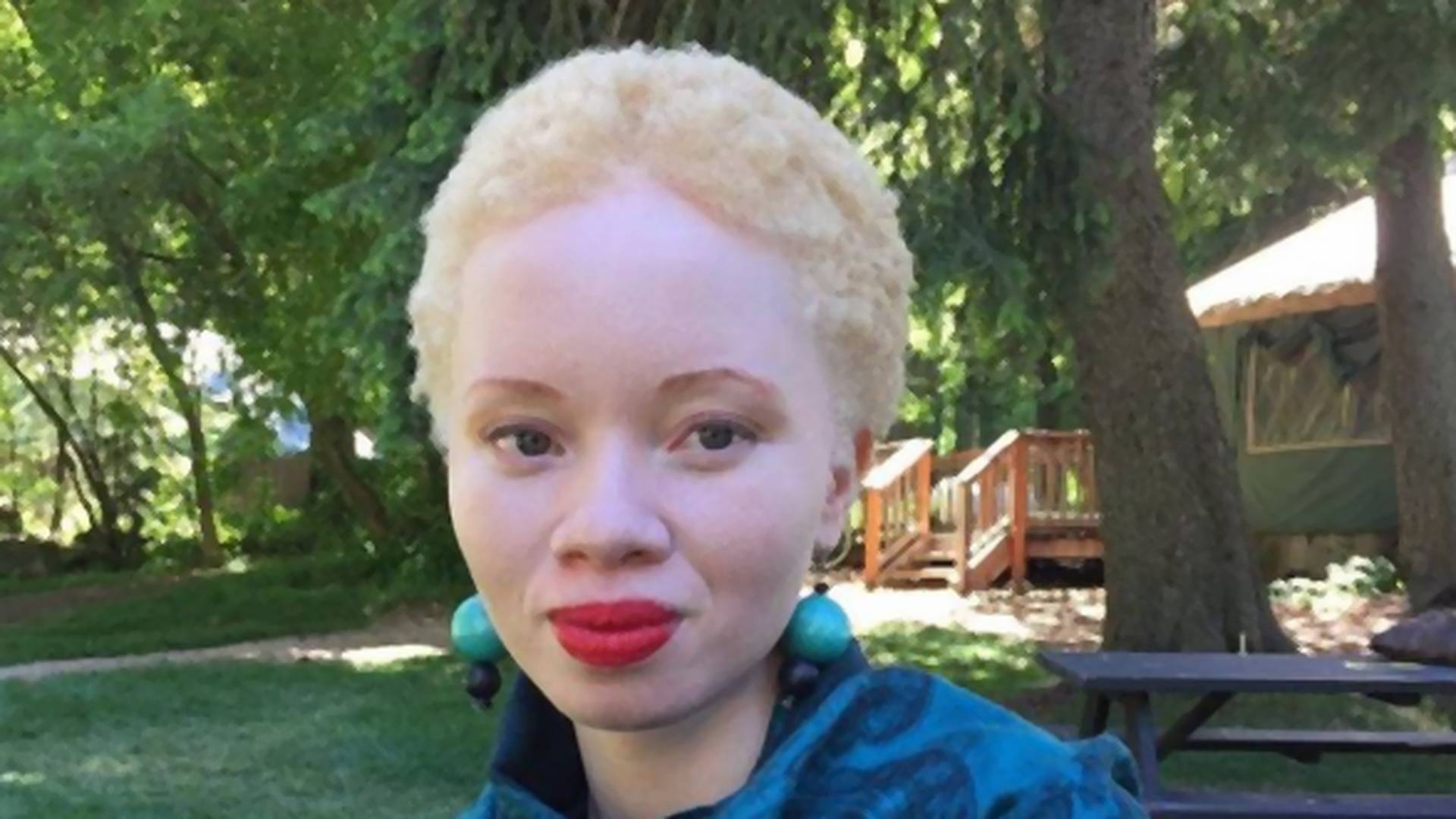 Prvi albino model na naslovnici magazina Vogue