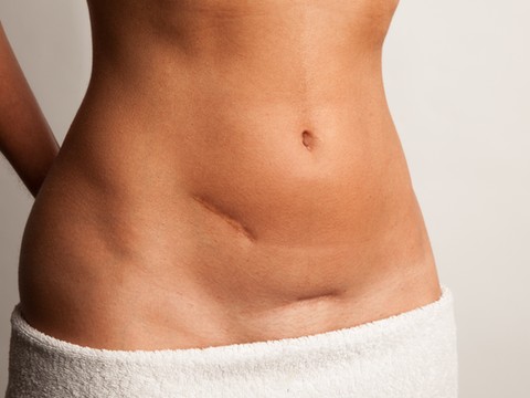 Znalezione obrazy dla zapytania blizna