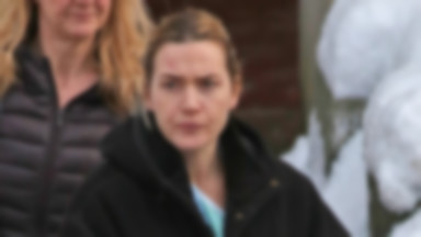 Siniaki na twarzy Kate Winslet. Aktorka kręci nowy film