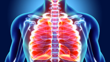 Zator tętnicy płucnej prowadzi do niedotlenienia serca - objawy i sposoby leczenia
