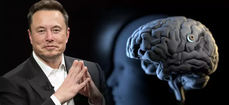 Elon Musk szuka ochotników do chipowania. Neuralink uruchomiło rekrutację