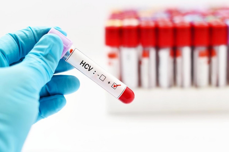 Źle wysterylizowane igły grożą zakażeniem HBV i HCV