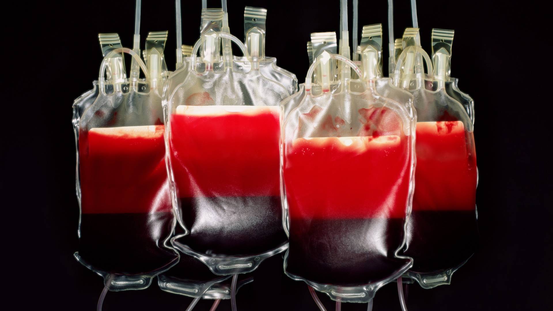Startap kupuje krv tinejdžera i prodaje ih bogatašima koji žele da žive večno
