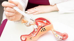 Polip endometrialny - objawy, diagnozowanie, leczenie, czynniki ryzyka
