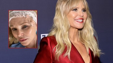 Christie Brinkley miała czerniaka. Pokazała zdjęcia