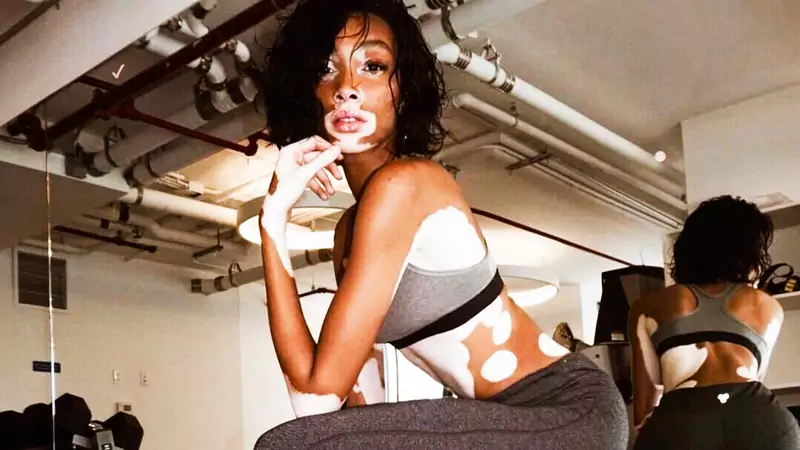 Winnie Harlow to pierwsza modelka z rozległym bielactwem nabytym, która wystąpi na pokazie Victoria&#39;s Secret 