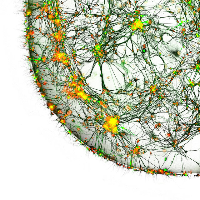 Neurony pobrano od pacjenta chorego na Parkinsona - 20-krotne przybliżenie