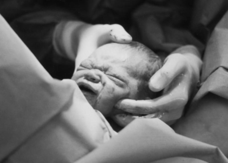 A túlhordott baba halva született, de az orvos nem akarja átengedni a túlvilágra. Csoda történt