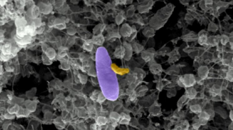 Micavibrio aeruginosavorus, vámpír-baktérium, antibiotikum, bioterrorozmus