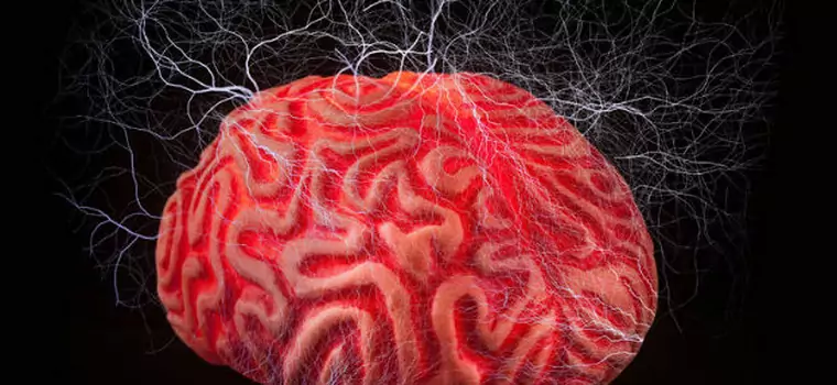10 dziwnych zjawisk zachodzących w mózgu