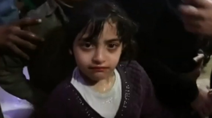 Így nézett ki a kislány a dúmai vegyifegyver-támadást követően /Fotó: BBC