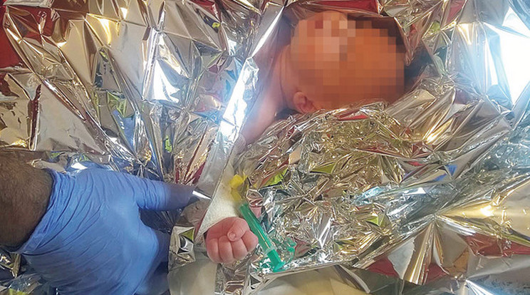 A tizenhárom napos gyereket apja hajszárítóval életveszélyesen megégette