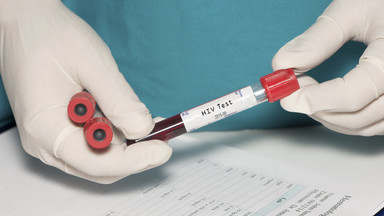 Klinika medyczna omyłkowo ujawniła dane pacjentów z HIV