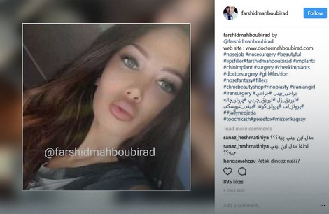 Soraja na Instagram stranici plastičnog hirurga