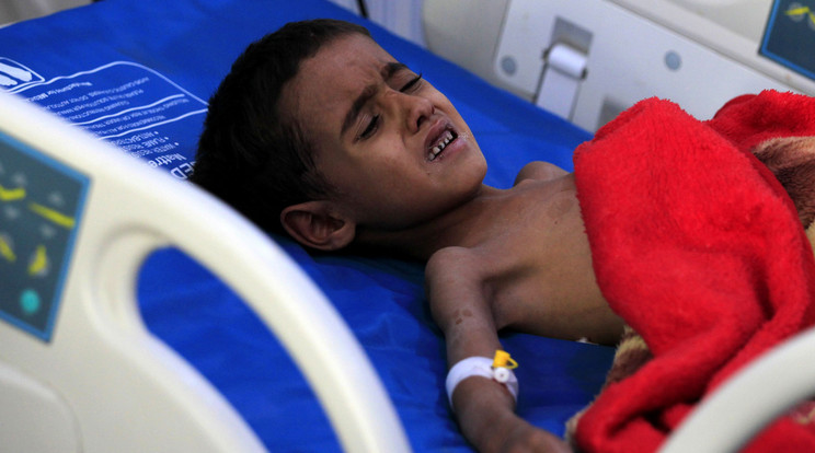 Diftériával fertőzött jemeni kisfiú egy szanaai kórházban 2018. október 29-én. A nélkülözés miatt gyorsan terjedt a diftéria a gyerekek közt a polgárháború sújtotta közel-keleti országban, ahol tavaly augusztus-szeptemberben közel 360 esetben jelentettek fertőzést, amely huszonhat esetben halálos kimenetelű volt. /
MTI/EPA/Jajha Arhab