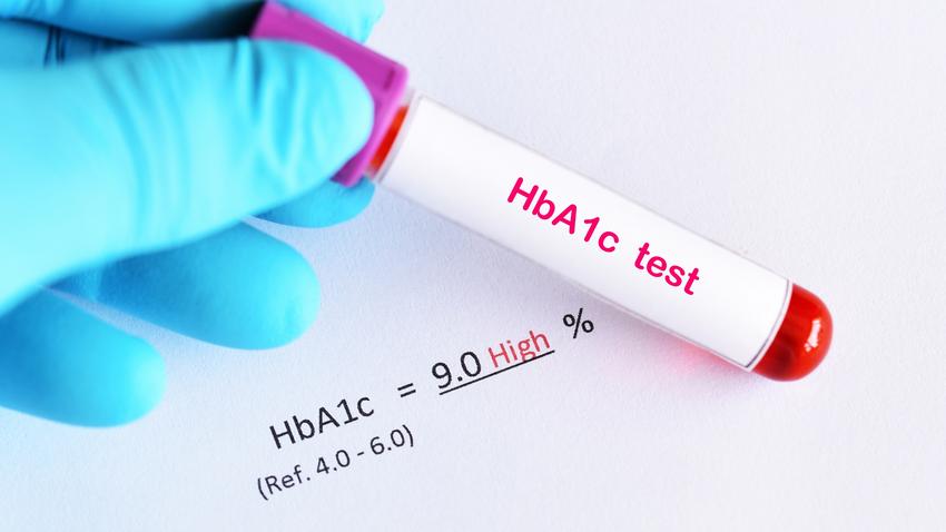 mit jelent magas HbA1c érték csökkentés cukorbetegség
