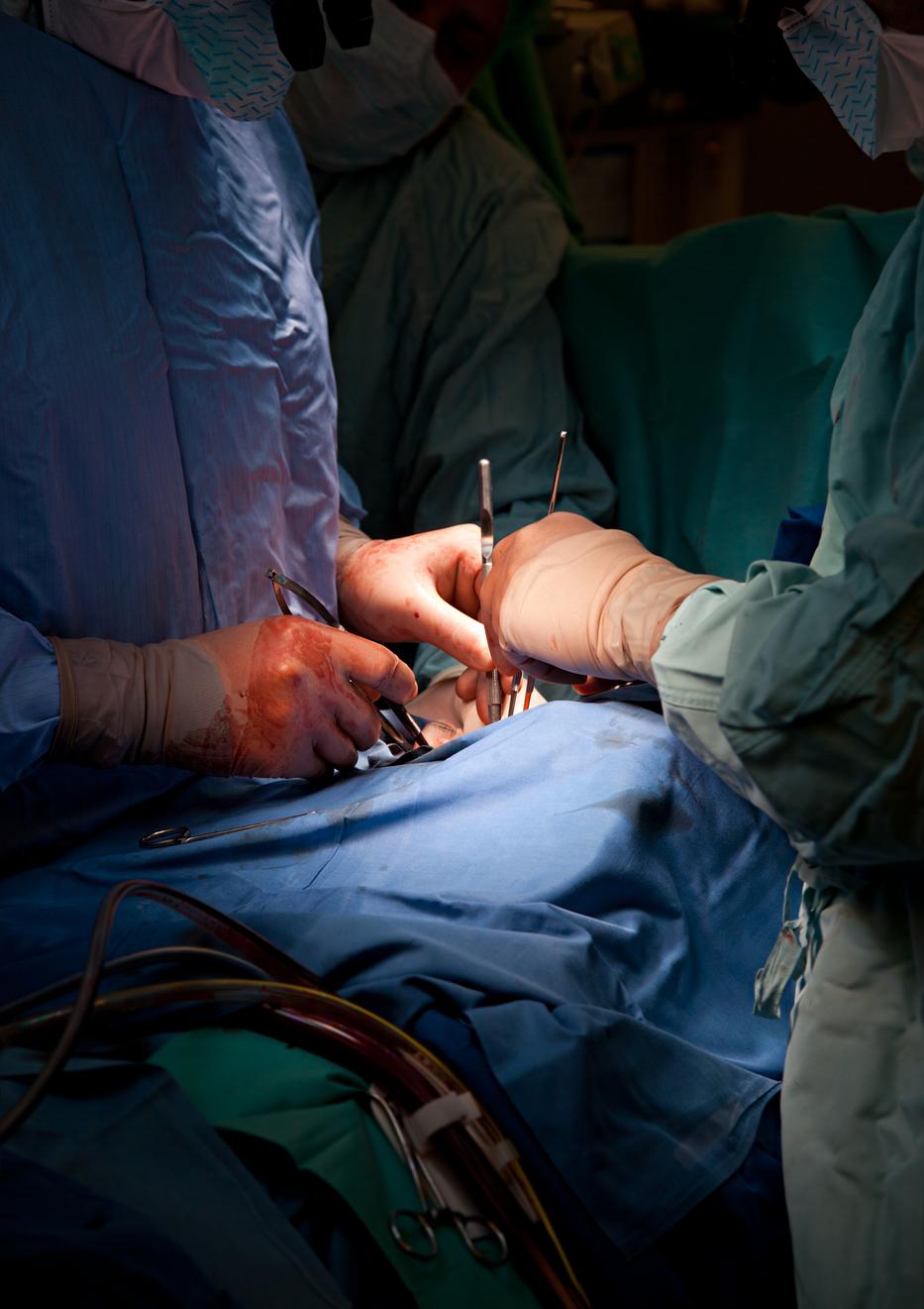Hibázott a sebész! Rossz páciens egészséges veséjét távolították el / Illusztráció: Northfoto