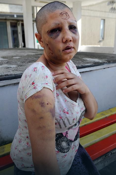 Pretrpela stravična mučenja: Marija nakon &scaron;to je otkriveno zlostavljanje