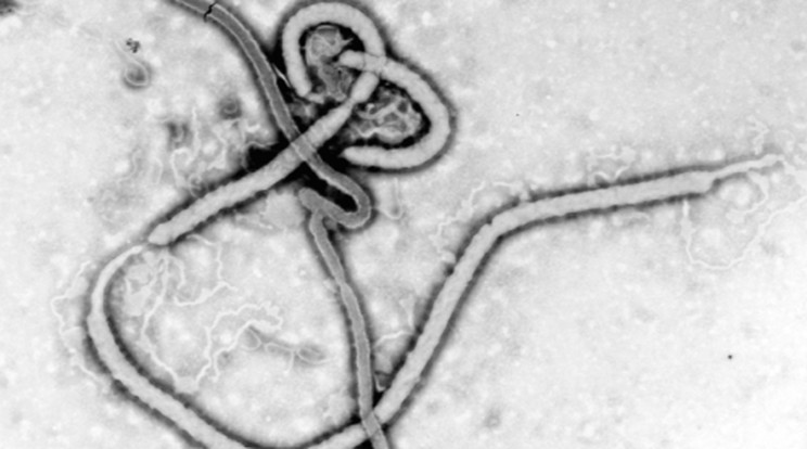 Kiderült: tényleg ebolás az amerikai beteg!