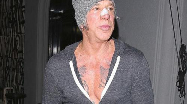 Mi történt? Bekötözött orral jár Mickey Rourke – fotók!