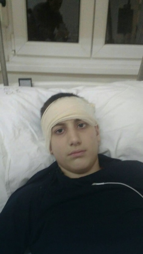 Borislav je u bolnici završio sa frakturom lobanje, prišivenom jetrom i bez slezine