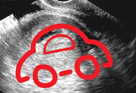 „Moja kobieta jest w ciąży z samochodem”. Zdjęcie USG potwierdza, że mężczyzna nie żartował