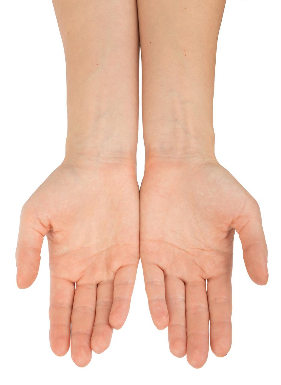 Vigyázz, ha zsibbad a kezed / fotó: Thinkstock